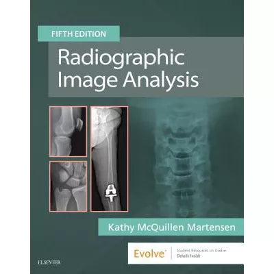 Radiographic Image Analysis E-Book : Radiographic Image Analysis E-Book